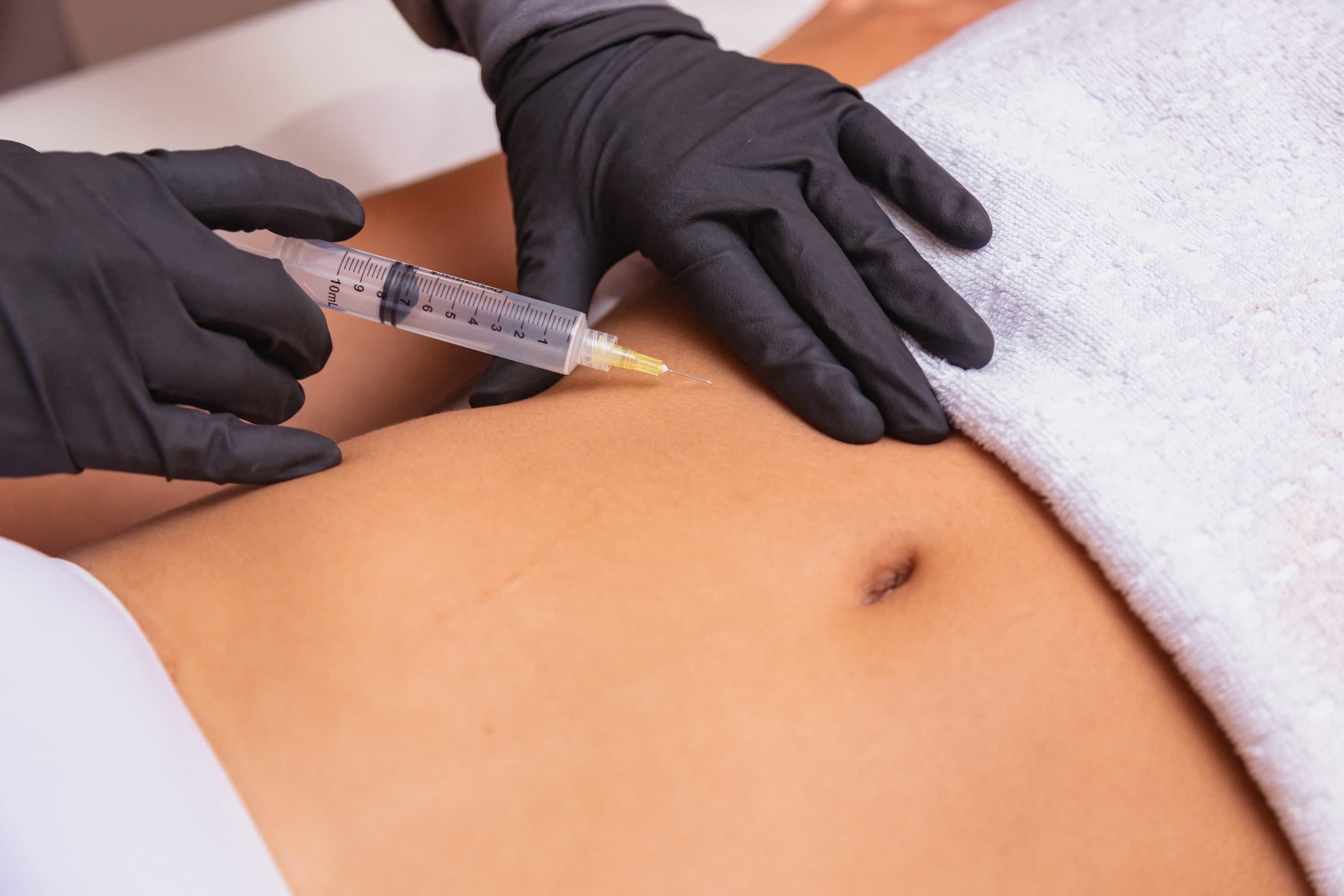 Regenerative micrografts prepared at London Cartilage Clinic