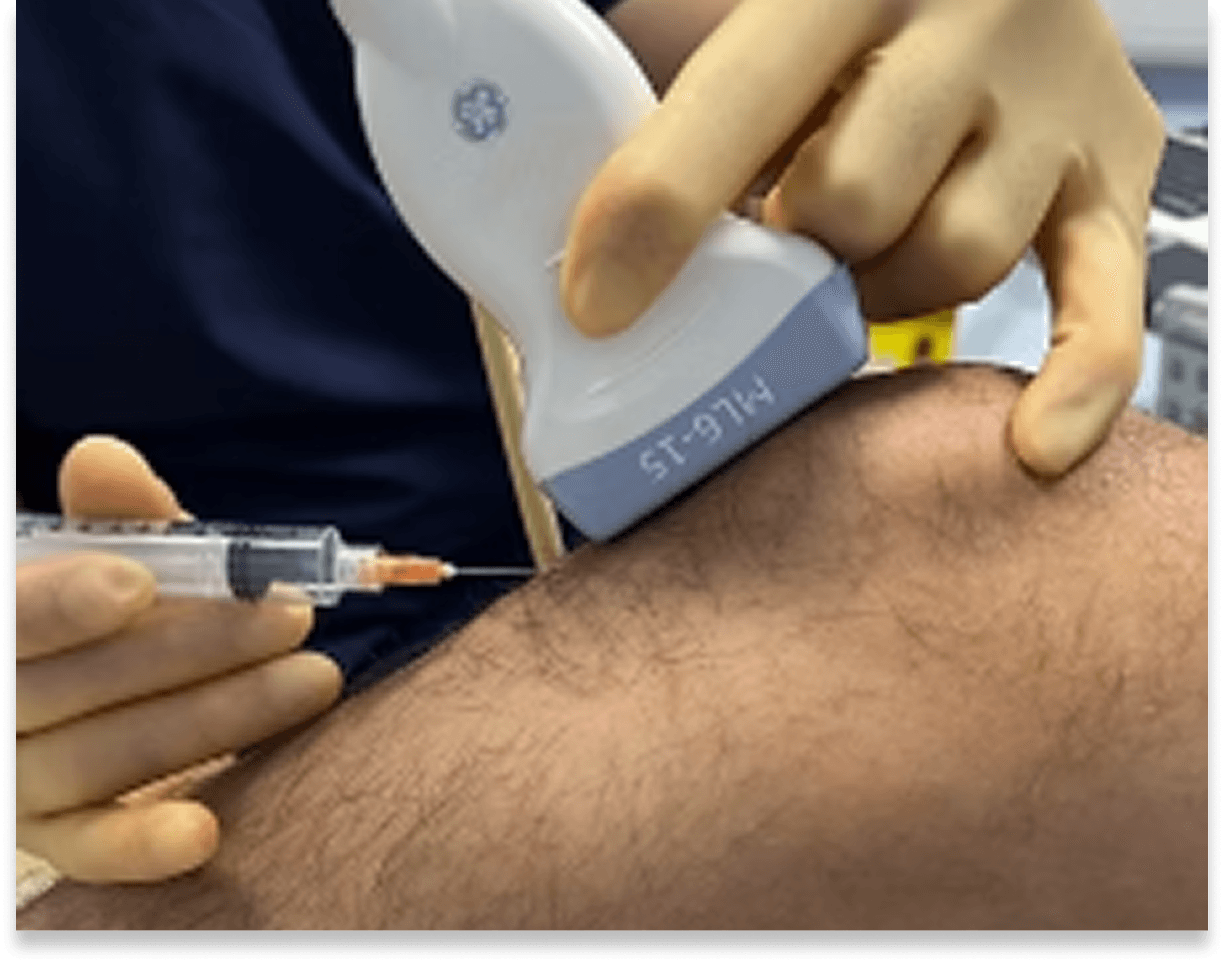 High-resolution MRI imaging used to confirm ACL injuries